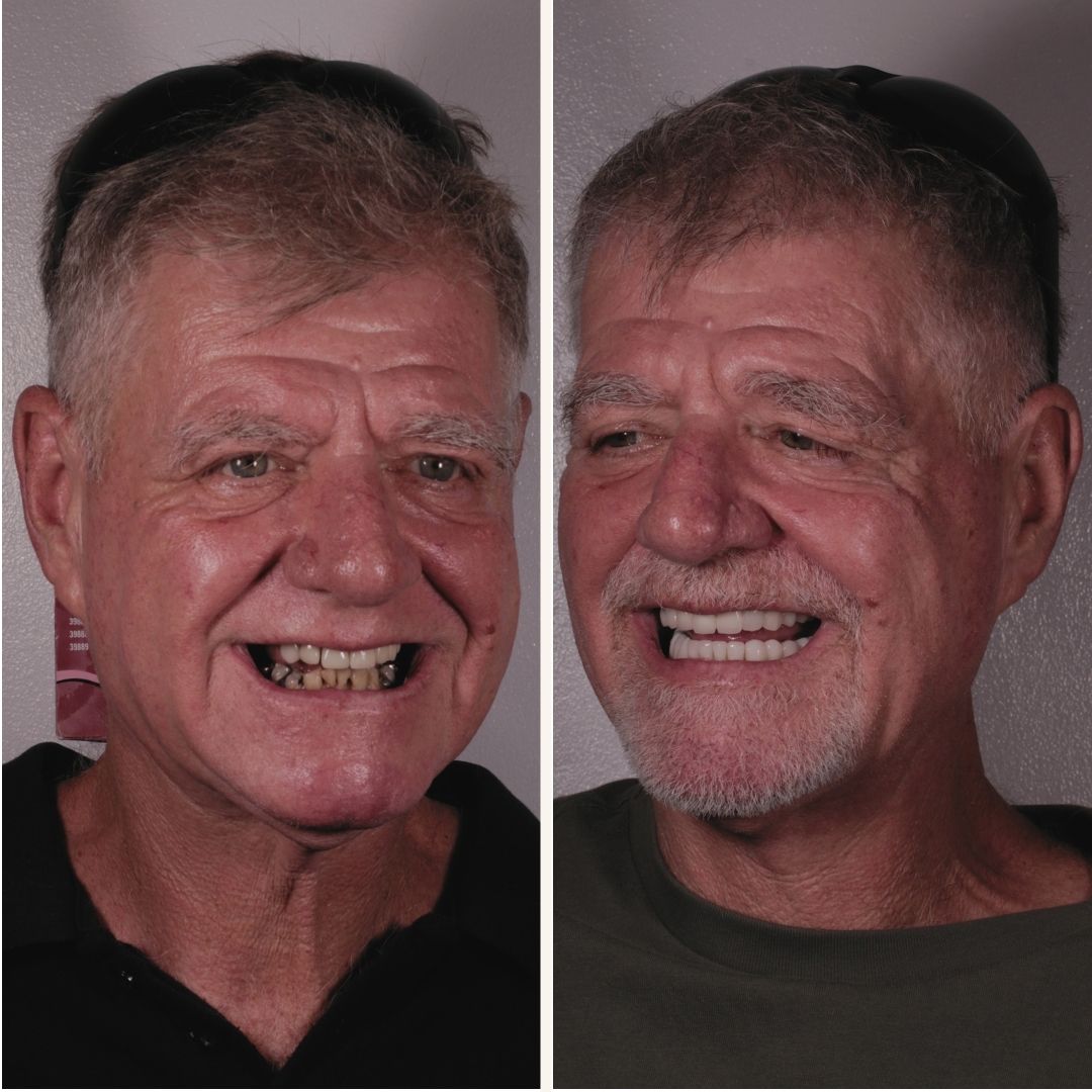 smilemakeover1
