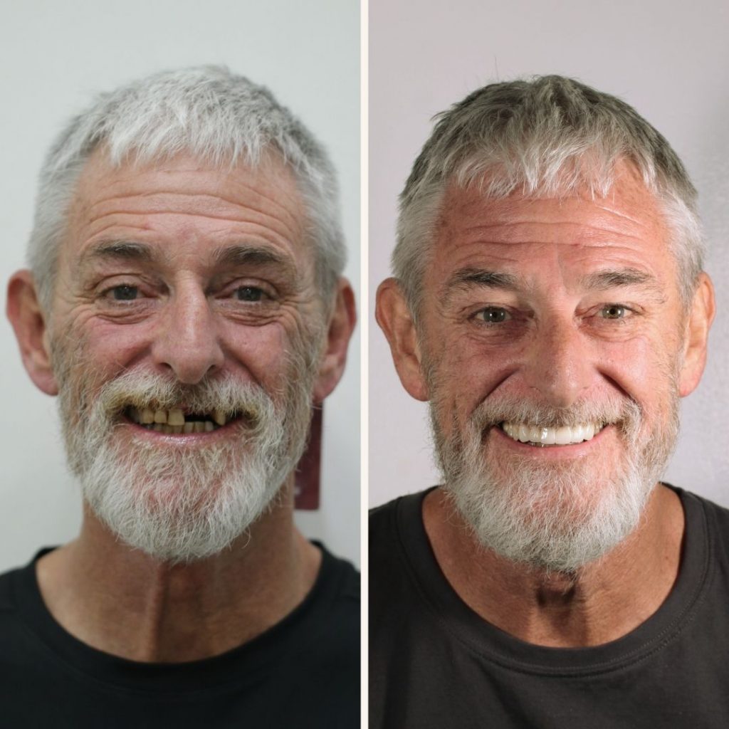 smilemakeover2
